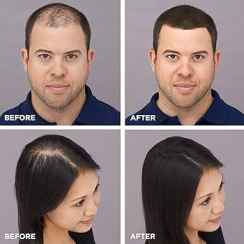 Buy 2 King Hair Fibers 27g & Get Fibers Hold Spray Free - Image 3